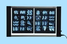 Thin Led X Ray View Box Application: Hospital