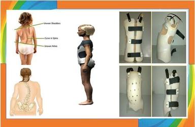  स्कोलियोसिस के लिए बोस्टन ब्रेस