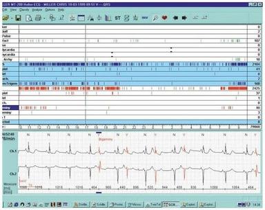 Microvit MT-200 Holter Monitoring Software