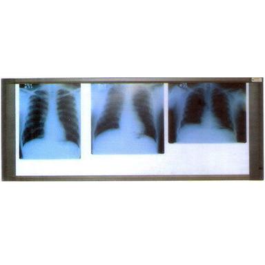 X Ray View Three Screen