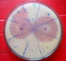  फॉस्फोरस सोलुबिलाइजिंग बैक्टीरिया