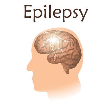 Epilepsy Treatment Services