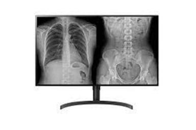 Latest Technology Lg 31 Inch 8 Mp Diagnostic Monitor With Ips Display For Hospital Use