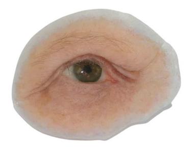 Beige 24 Millimeter Round Silicone Elastomer Orbital Prosthesis