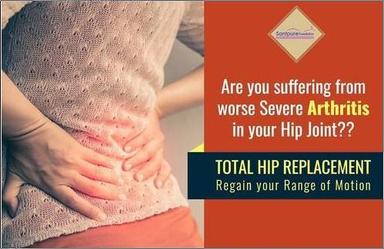 Total Hip Replacement Surgery Services
